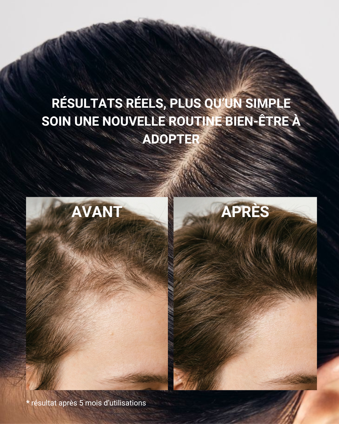 PEIGNE EN BOIS STIMULATEUR CUIR CHEVELU